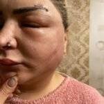 'Medihol' klinikasında başına oyun açdılar - Foto-fakt