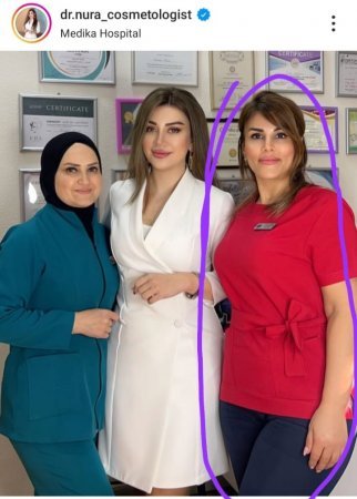 Bakıda Tanınmış Klinika və kosmetoloji "həkim" Hakim qarşısında – Vətəndaş 18.300 manat təzminat tələb edir