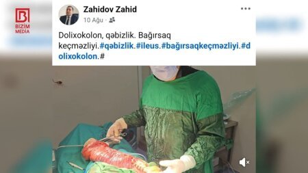 Daha bir tanınmış cərrah əməliyyatını açıq şəkildə PAYLAŞDI – Araşdırma BAŞLADI - FOTOFAKT